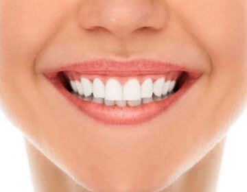 White Teeth DIY Tips - girlsnbeauty.com