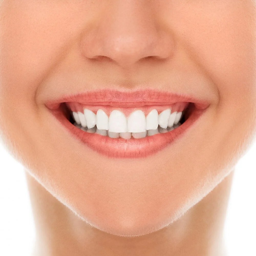 White Teeth DIY Tips - girlsnbeauty.com
