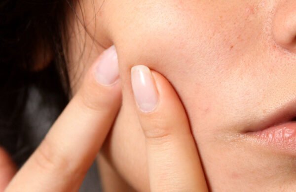 steps to pop the pimple