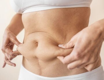 Extended tummy tuck-girlsnbeauty.com