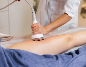 Laser Lipolysis-girlsnbeauty.com