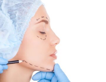 Facial feminization surgery-girlsnbeauty.com