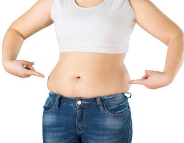 Mini tummy tuck - everything you need to know - girlsnbeauty.com
