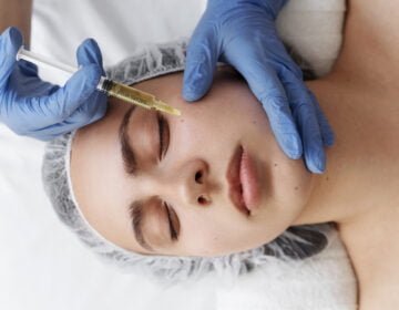 Blepharoplasty Everything You Need to Know About Eyelid Surgery -girlsnbeauty.com.