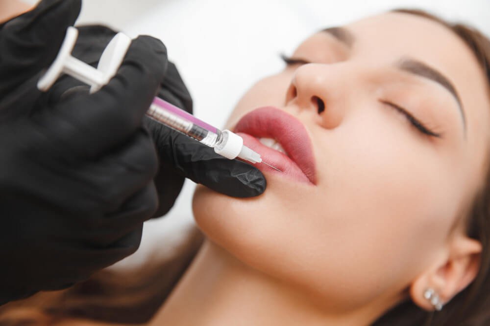 Lip Fillers Near Me: Everything you need to know 1 Lip Fillers Near Me Everything you need to know - girlsnbeauty.com