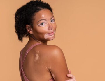 Unrealistic beauty standards of today's world - girlsnbeauty.com