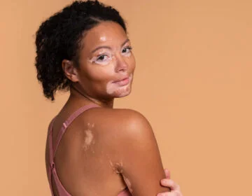 Unrealistic beauty standards of today's world - girlsnbeauty.com