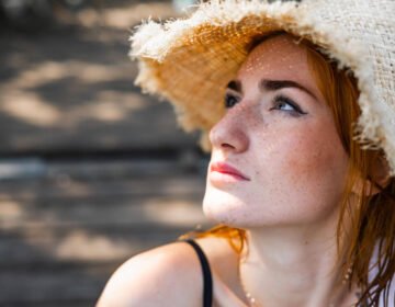 Best self-care tips to recover from sunburn and sun rashes - girlsnbeauty.com