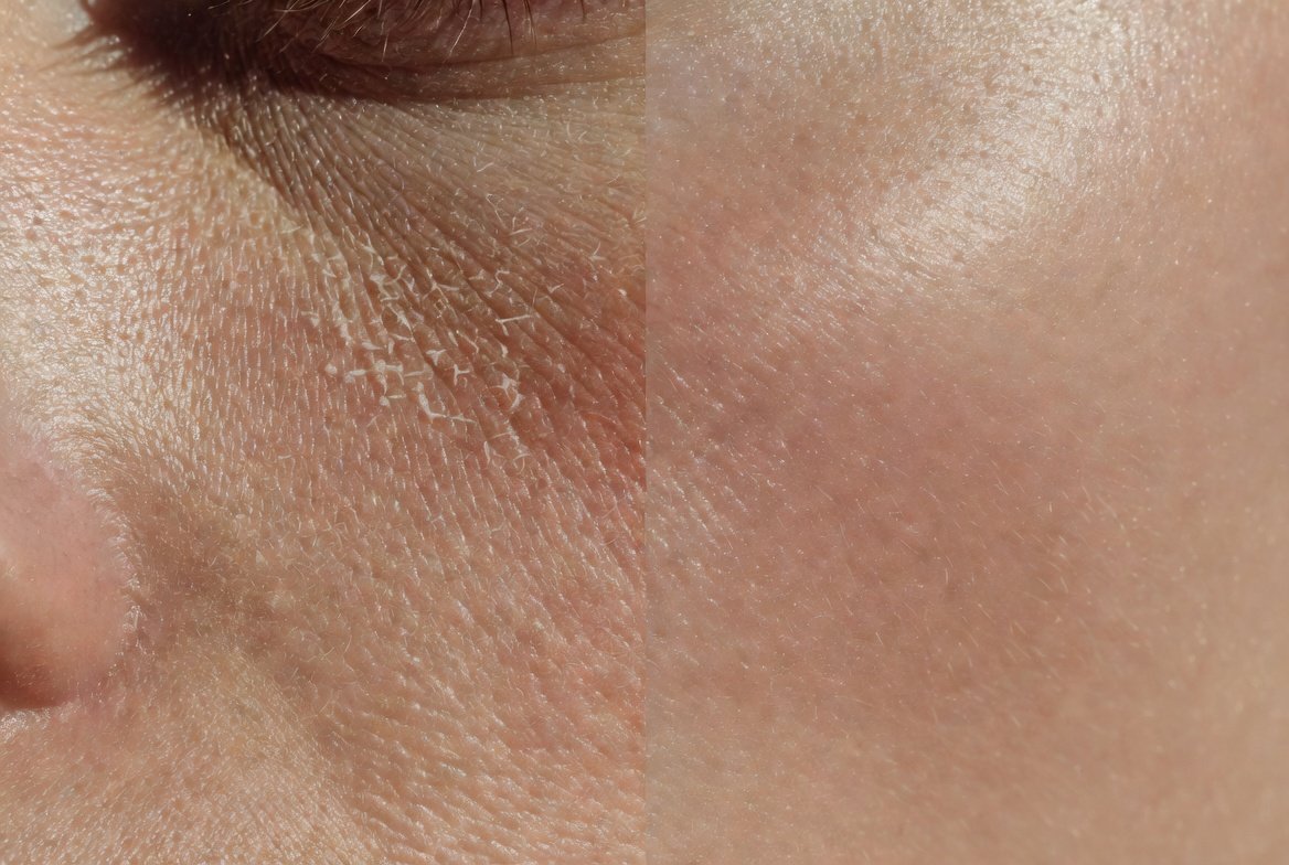 7 Signs Your Skin Barrier is Damaged (And the 3 Products That Will Repair It FAST)